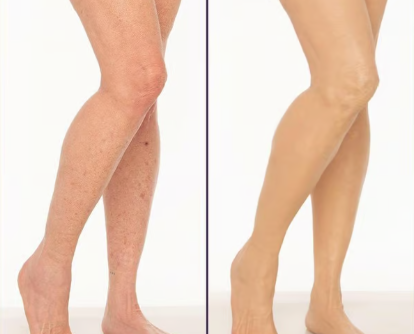 Supreme Crème™ - Hidratante, Corrector y Cobertura todo en uno 💧✨ Liviano y Resistente al agua