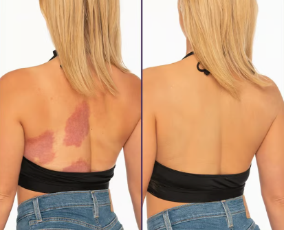 Supreme Crème™ - Hidratante, Corrector y Cobertura todo en uno 💧✨ Liviano y Resistente al agua